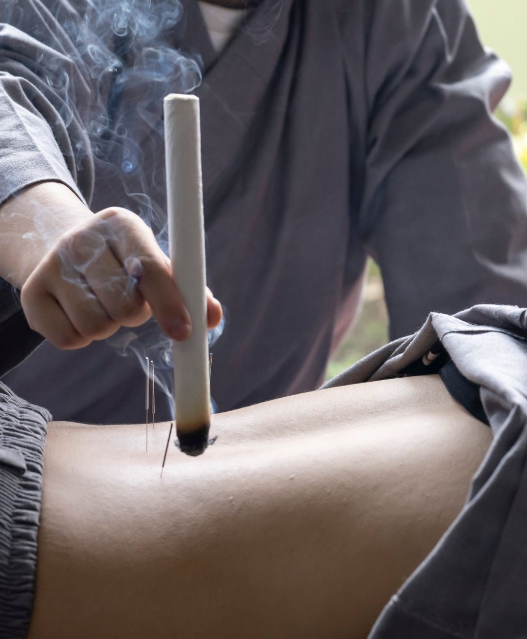 Moxibustion